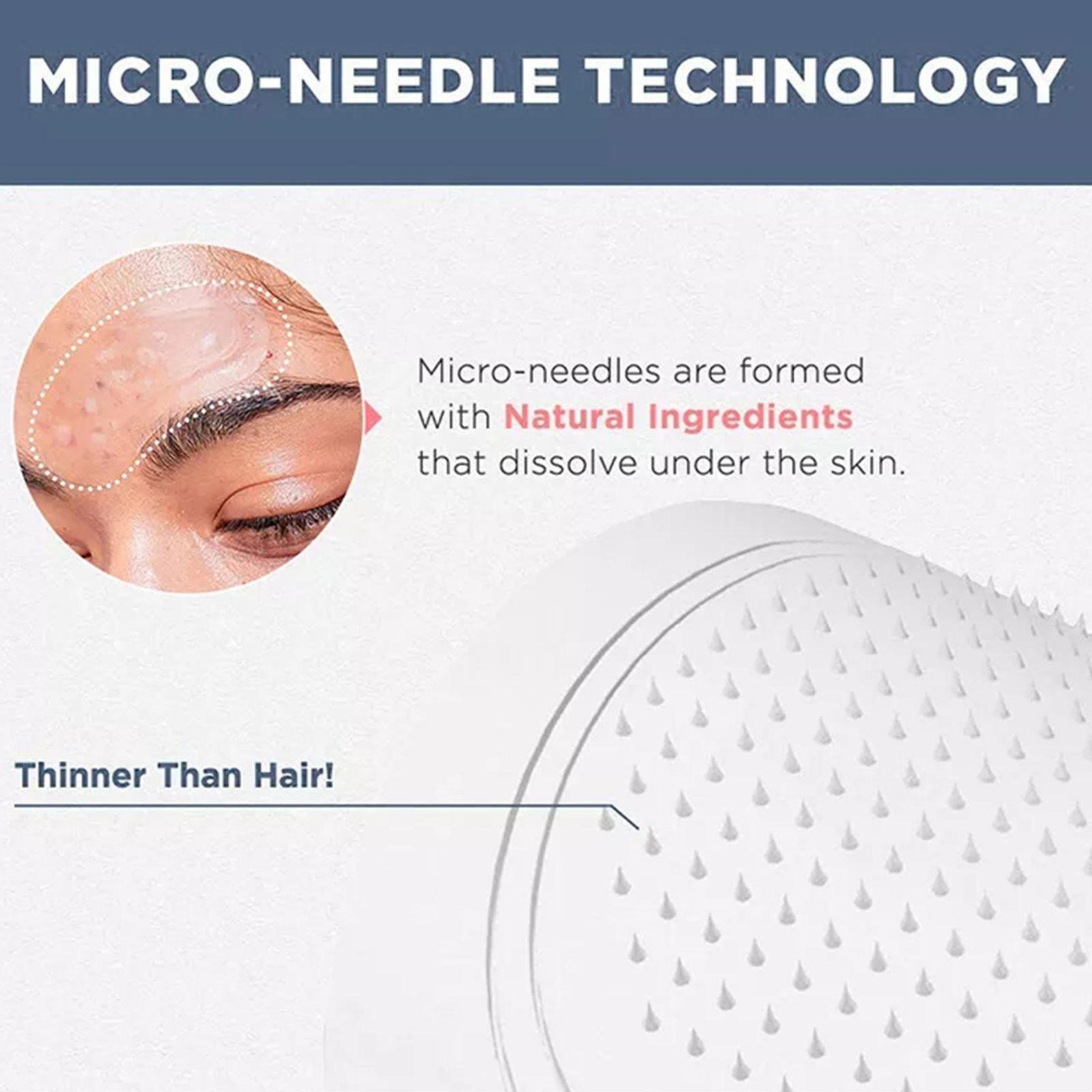 0.2mm Mikro İğneli Göz Maskesi - Collagen Eye Patch incelemesi ve fiyatı