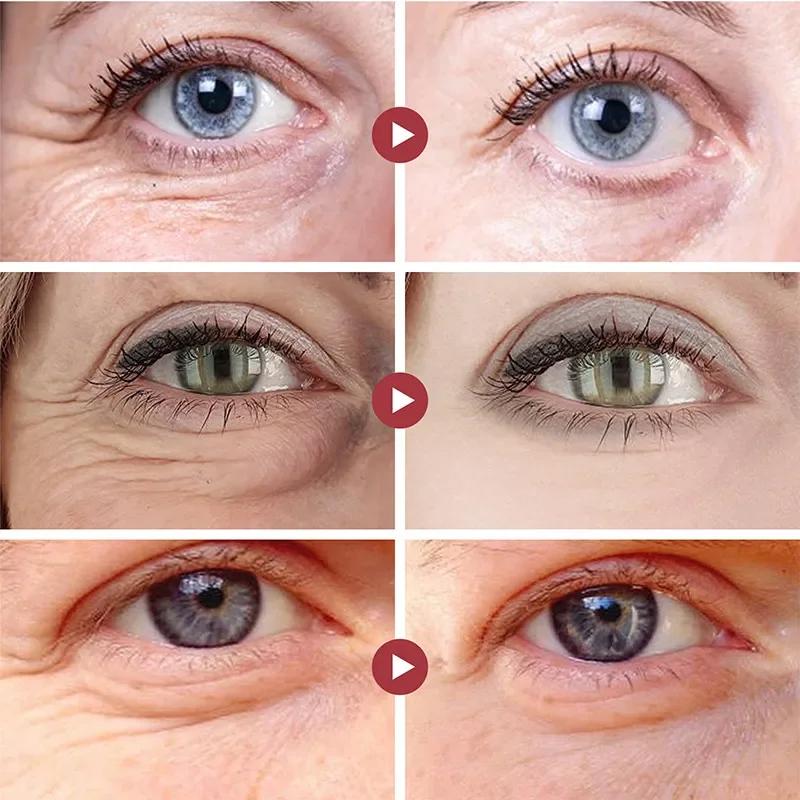 Kırışıklık Giderici Göz Bantla - Collagen Eye Patch incelemesi ve fiyatı